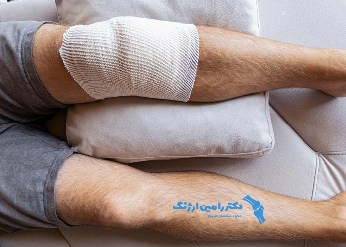 استراحت بعد از آرتروسکوپی زانو