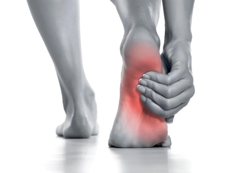 خار پاشنه چیست؟