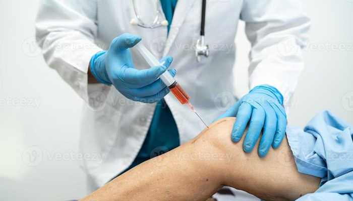 مزایای درمان PRP برای زانو