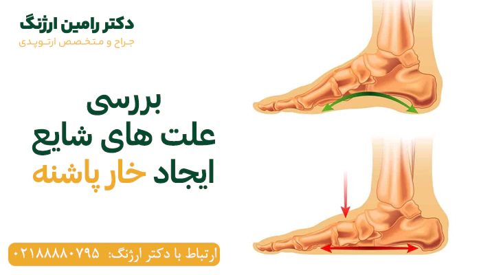 چرا خار پاشنه به وجود می آید؟