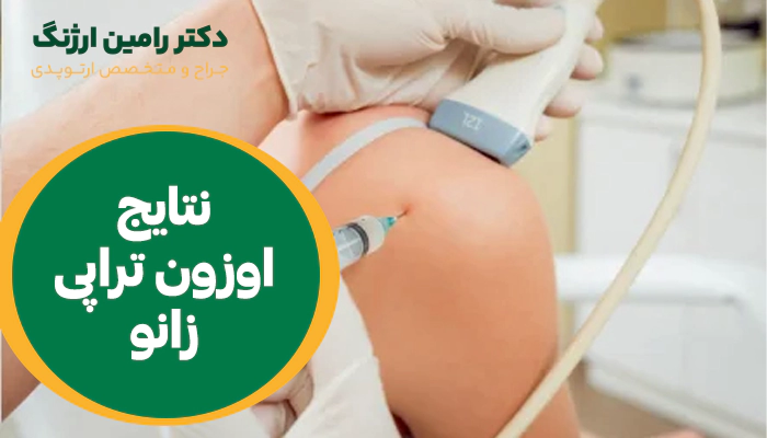 نتیجه تزریق اوزون به زانو چیست؟