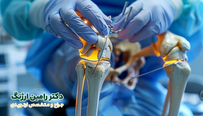 پروتز زانو تا کی ماندگاری دارد؟