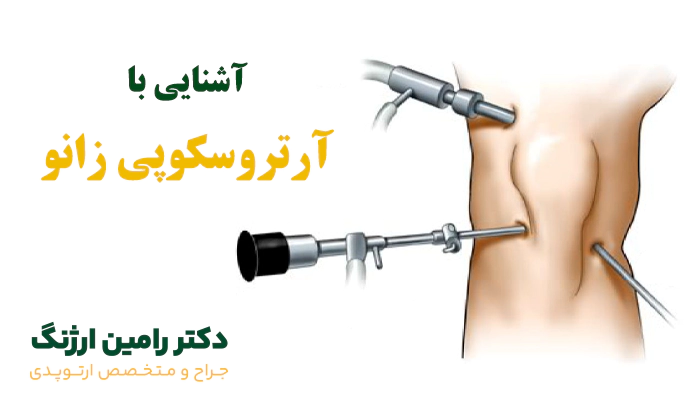 آشنایی با آرتروسکوپی زانو با دکتر رامین ارژنگ