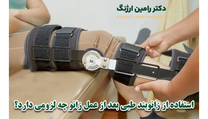 استفاده از زانوبند طبی بعد از عمل زانو چه لزومی دارد؟