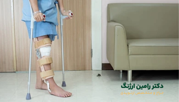 تا چه مدت باید از زانوبند بعد از جراحی زانو استفاده کرد؟