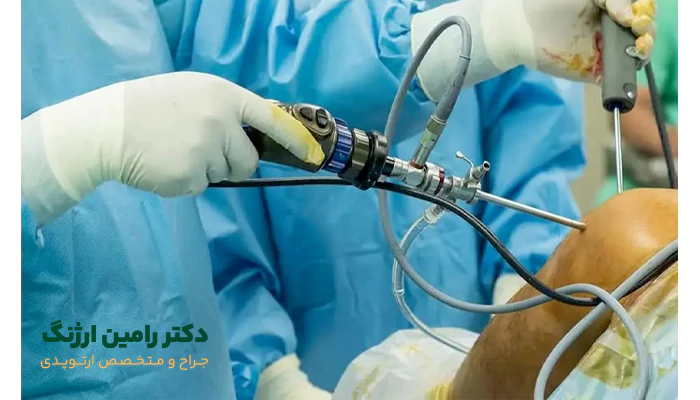 تاثیر نوع جراحی در هزینه جراحی زانو