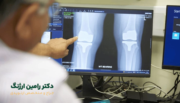 هزینه آزمایش و عکس برداری قبل جراحی زانو