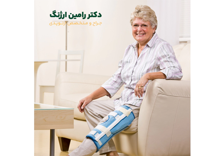 چه کسانی باید حتما از زانوبند بعد از جراحی زانو استفاده کنند؟