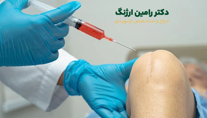 آیا بیمه هزینه پی آر پی زانو را پوشش میدهد؟