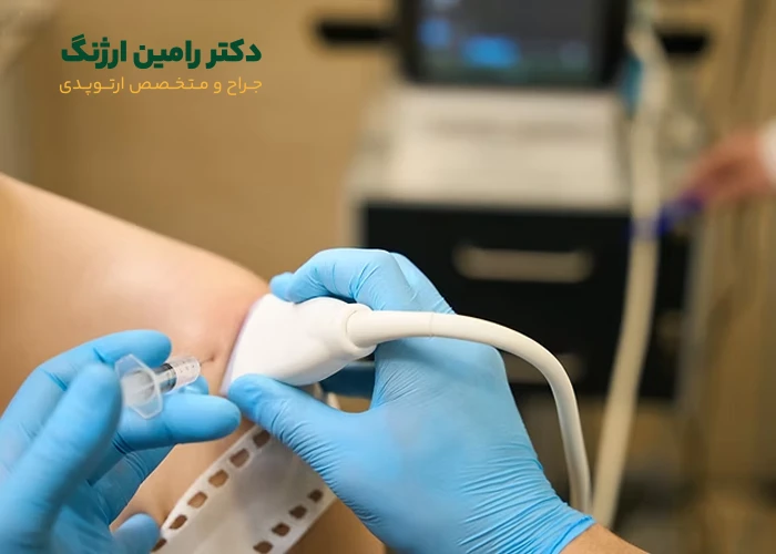 تزریق پی آر پی به زانو با سونوگرافی