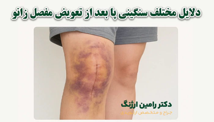 دلایل مختلف سنگینی پا بعد از تعویض مفصل زانو