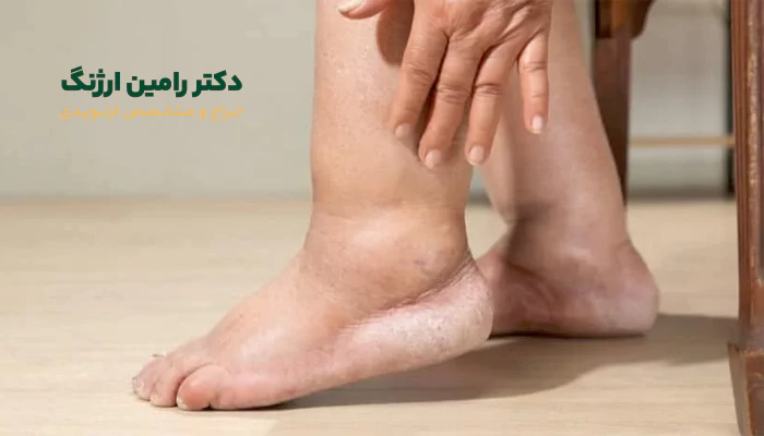 چطور تشخیص دهیم سنگینی پا بعد جراحی زانو طبیعی است یا خطرناک؟